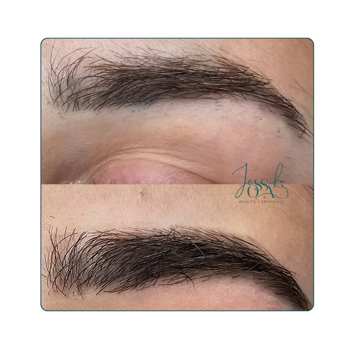 regeneración de cejas valencia